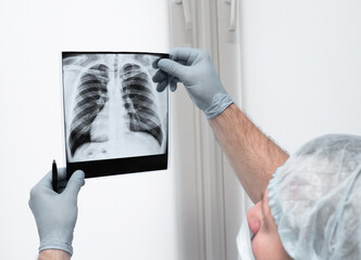 Medical worker in the office with x-ray. A radiographer analyzes an X-ray of the lungs....