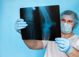 Bone disease. Doctor traumatologist otoped analyzes a knee injury of a person's leg. X-rays of the...