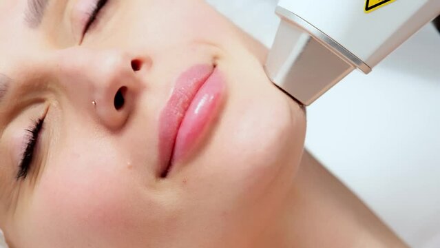 Close-up of a woman's face in a laser hair removal salon. A girl undergoes laser hair removal procedure on her face. Concept of removing unwanted hair.