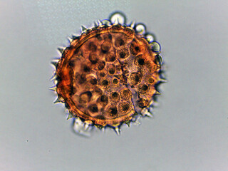 photo of tiny microorganisms under the microscope
