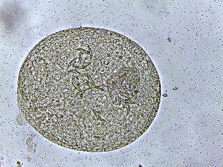 photo of tiny microorganisms under the microscope
