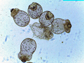 photo of tiny microorganisms under the microscope
