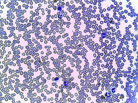 photo of bacteria microorganisms under the microscope
