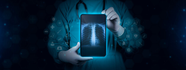 Chest x-ray. The doctor examines and studies a chest X-ray photographic plate. Scene of a doctor...
