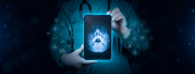 The doctor holds a tablet and examines an x-ray of the paranasal sinuses, the deviation of the...