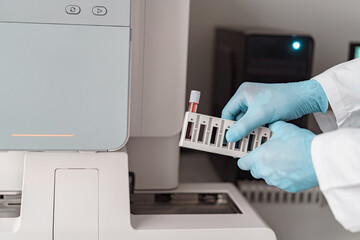 Close up of scientist holding test tubes at laboratory. Medicine and research in chemistry
