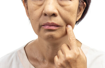 Flabby and wrinkled skin on senior woman face. - obrazy, fototapety, plakaty