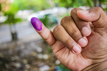 a picture of a man's hand. The ink on a man's finger was obtained after voting during the regional...