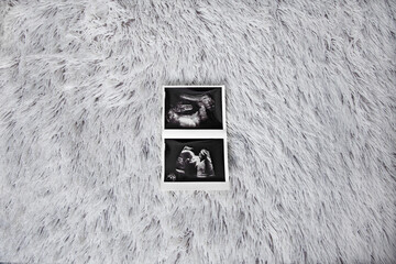 Ecografía sobre manta de lana gris. Nueva llegada al mundo. Bebe en camino. Ecografía de bebé doble