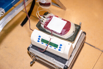 Scale weighing the bag of blood extracted from a donor