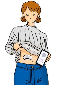 Person with CGM