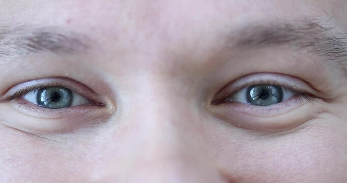 Blue eyes of young man. Hyperopia myopia in humans concept