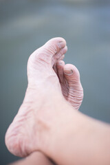 The feet and toes of elderly people have dry, wrinkled skin.