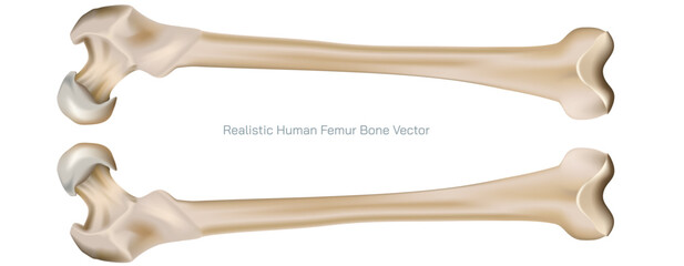 Types of bone fracture. Structure of a bone vector illustration. The quality or structure changes in marrow density. Build and strength of bone tissues. Stymptoms and stages and  growth. Bone anatomy.