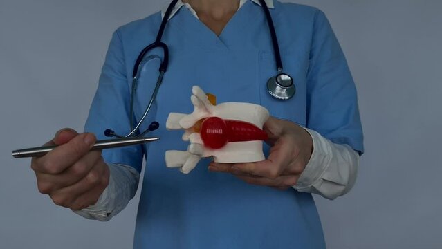 Close up of doctors hand holding a model and pointing at a herniated disc with a pen, isolated on a white background