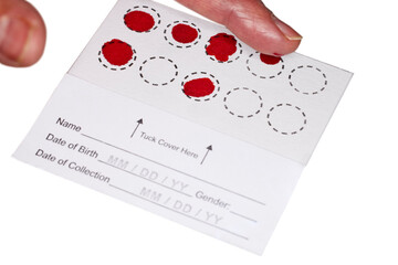 Blood Spot test card with droplets of blood for hormone testing