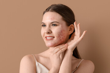Young woman with acne problem on brown background, closeup