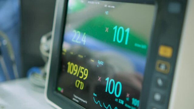 Medical vital signs monitor in hospital. Monitor for anesthetic surgery.