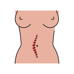 Mildline incision line icon. Abdominal incisions. - obrazy, fototapety, plakaty