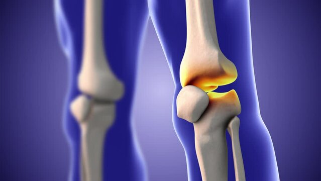 Discomfort and pain in the knees