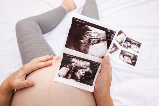 Close-up of a pregnant woman holding an ultrasound scan. Pregnant woman holding ultrasound image.