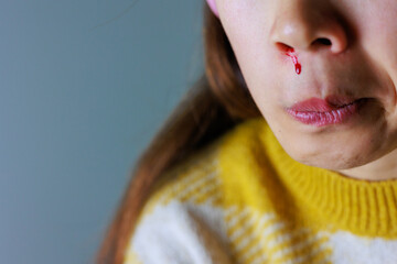 鼻から血が流れる女性の口元（パーツカット）