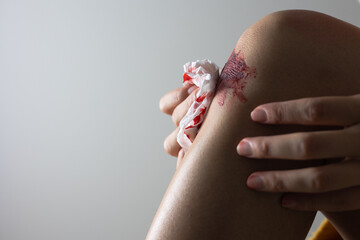 出血した膝の手当てをする女性（顔なし）