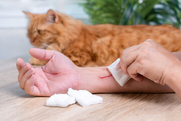 First aid Wounds from cat scratches, Clean to prevent infection, A man uses medical cotton wool to...