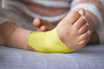 Elastic therapeutic yellow tape applied to child leg. Kinesio Taping therapy for injury