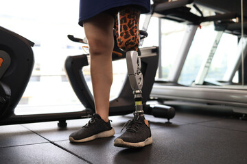 Low angle view at woman with prosthetic leg walking in treadmill at fitness gym