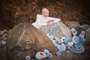 Young hairless girl with alopecia in white futuristic costume lying pensively among surreal landscape with many eyes stones, symbolizes introspection and reevaluation of individuality