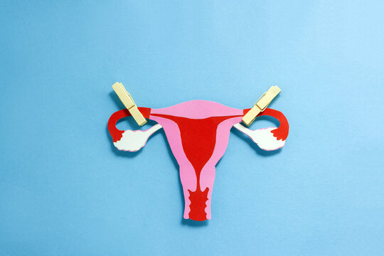 Paper сut made anatomical structure of female uterus with clothes peg on fallopian tubes. Female sterilization concept. Selective focus, copy space