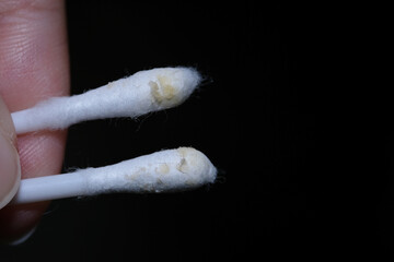 Macro shot of dry earwax on cotton buds