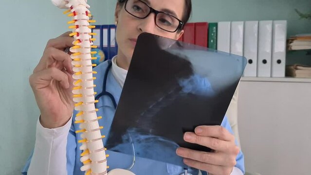 Surgeon examines an x-ray of spine for medical diagnosis of the health status of a patient with spinal diseases. Medic treating bone cancer, spinal muscular atrophy, medical care concept