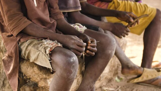 9 jan. 2024,Gwalada,Nigeria: Malnourished child due to extreme poverty, hunger, drought and climate change in Nigeria Africa . Rural African children Poor living conditions.poverty hunger in Africa