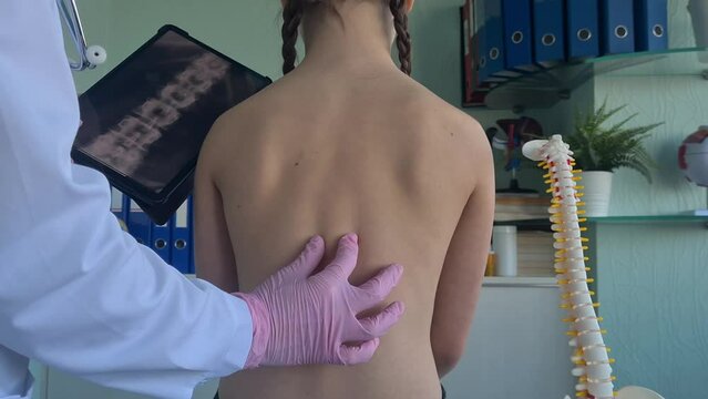 A young girl sits in a doctors office as the doctor examines her back for signs of scoliosis