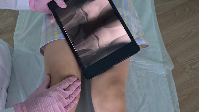 A doctor in pink gloves examines a patients knee using a tablet and x-ray image.
