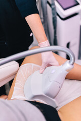 Beauty salon client, a woman getting a cryolipolysis procedure on her thigh to reduce fat by a beautician - 739936033