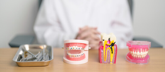 Tooth Anatomy and Orthodontic model on dentist table. Oral Teeth and disease. March Oral health, Dentist Day, False Teeth. Toothache and Children Dental Health Month and May Orthodontic Health Day