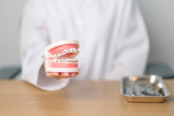 Dentist with Orthodontic tooth model and bracket or brace. Clean and Scrape off tartar. May...