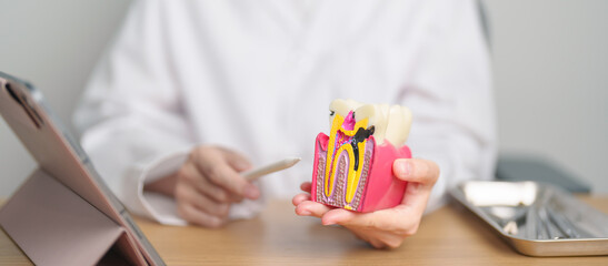 Dentist with tooth Anatomy model. Oral Teeth decay and disease, Scrape off tartar. March Oral health, Dentist Day, False Teeth. Toothache and Children Dental Health Month and Orthodontic Health Day