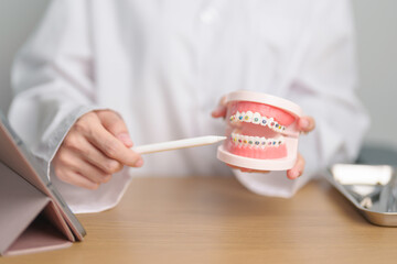 Dentist with Orthodontic tooth model and bracket or brace. Clean and Scrape off tartar. May...