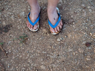 Man wade through the mud until both their feet and white flip-flops are dirty with dirty clay. They...