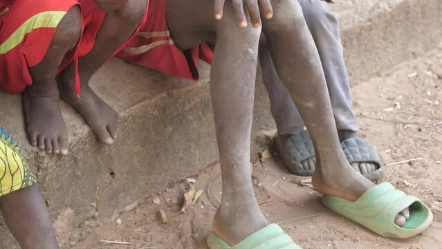 9 jan. 2024,Gwalada,Nigeria: Malnourished child due to extreme poverty, hunger, drought and climate change in Nigeria Africa . Rural African children Poor living conditions.poverty hunger in Africa