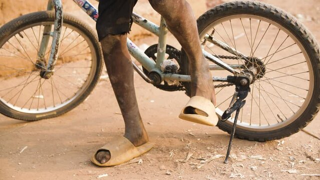 9 jan. 2024,Gwalada,Nigeria: Malnourished child due to extreme poverty, hunger, drought and climate change in Nigeria Africa . Rural African children Poor living conditions.poverty hunger in Africa