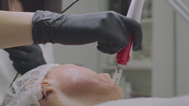 Close-up of a woman face. Needle mesotherapy procedure into the skin of the face