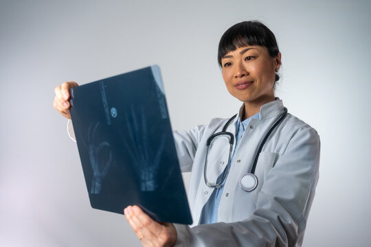 Positive Asian female doctor looking at the x-ray picture of hand in hospital. Japanese professional female doctor examining patient's x-ray of human hand during a visit
