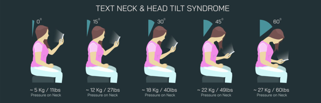 Text Neck Syndrome of phone posture is the onset of cervical spinal degeneration from excess look down at mobile screens. Aka Anterior head prevention. Cervical neck aches vector illustration. 