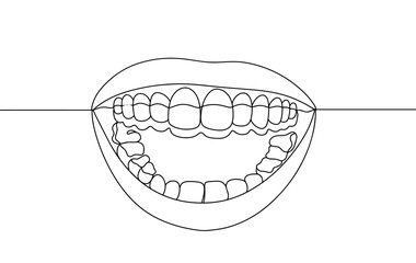 Mouth. Aligners. Teeth. Dentist