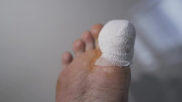 An injured toe with net bandage